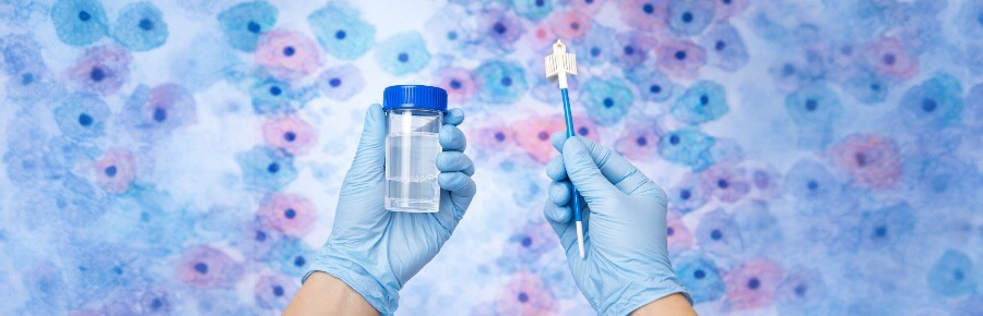 Жидкостная цитология соскобов шейки матки и цервикального канала: современный метод диагностики рака